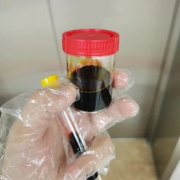 急性肝衰竭！兩兄弟誤吃這種菌 專家提醒